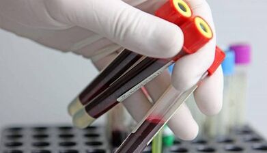 Come fare test per i parassiti nel corpo