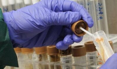 La necessità di passare l'analisi dei parassiti