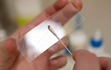 Quali test dovrebbero essere eseguiti per i parassiti
