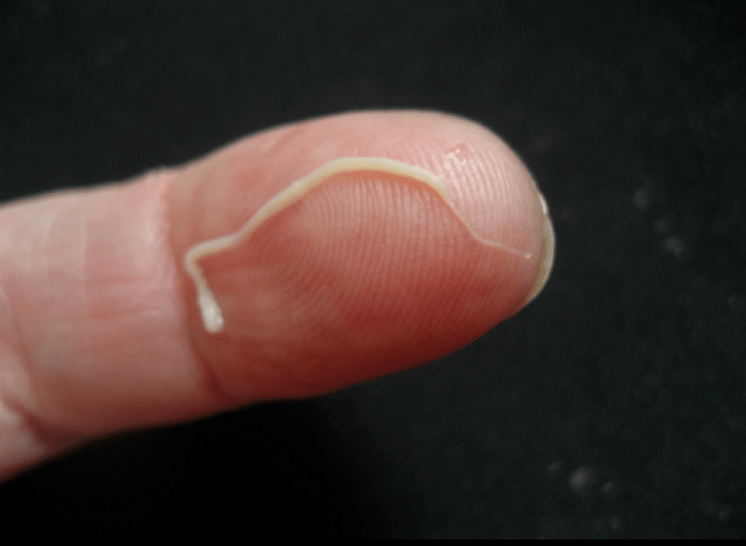 Parassita dei nematodi del corpo umano