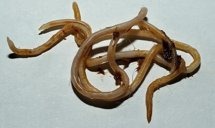 Toxocara dal corpo umano